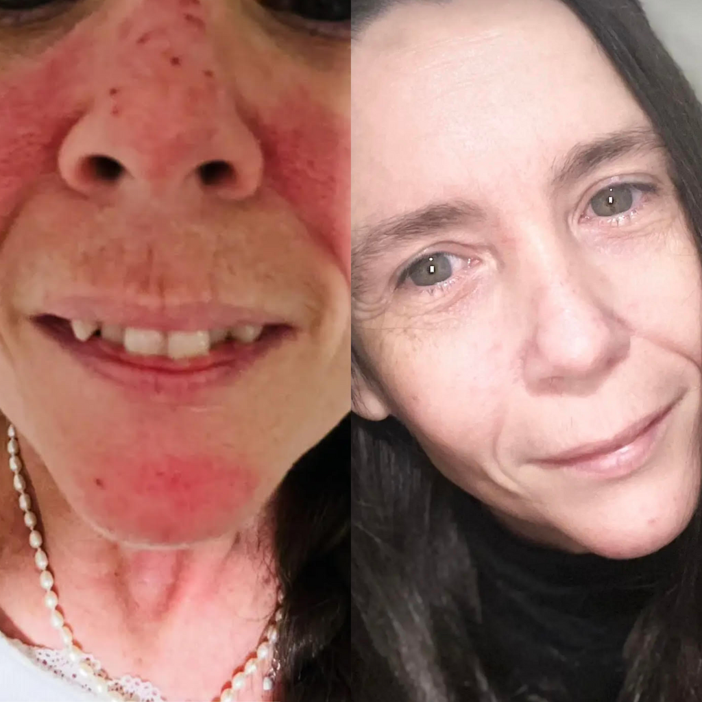 Aqua Kiss Blue Glow 30ml